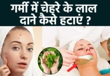 गर्मी में त्वचा पर हो रहे दानों से परेशान? अपनाएं ये असरदार घरेलू नुस्खे गर्मी में त्वचा पर हो रहे दानों से परेशान? अपनाएं ये असरदार घरेलू नुस्खे
