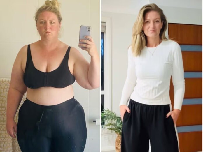 Weight Loss Transformation: महिला ने कुछ ही महीनों में घटा लिया 70kg वजन, बताई 5 जरूरी बातें