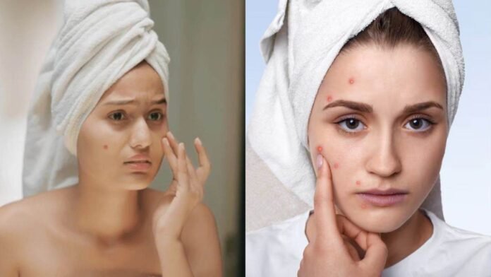Skincare Tips: श्वेता तिवारी जैसा नेचुरल ग्लो, महंगे फेशियल नहीं—ये देसी नुस्खे करेंगे कमाल