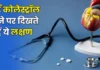 Health Alert: सीने में हल्का दर्द और ये चार संकेत हाई कोलेस्ट्रॉल का खतरा बता सकते हैं Health Alert: सीने में हल्का दर्द और ये चार संकेत हाई कोलेस्ट्रॉल का खतरा बता सकते हैं