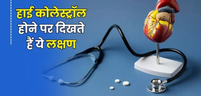 factrecorder Health Alert: सीने में हल्का दर्द और ये चार संकेत हाई कोलेस्ट्रॉल का खतरा बता सकते हैं