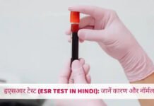 ESR टेस्ट क्यों जरूरी होता है? इंफेक्शन में बढ़ने-घटने के क्या संकेत देता है ये ब्लड टेस्ट ESR टेस्ट क्यों जरूरी होता है? इंफेक्शन में बढ़ने-घटने के क्या संकेत देता है ये ब्लड टेस्ट