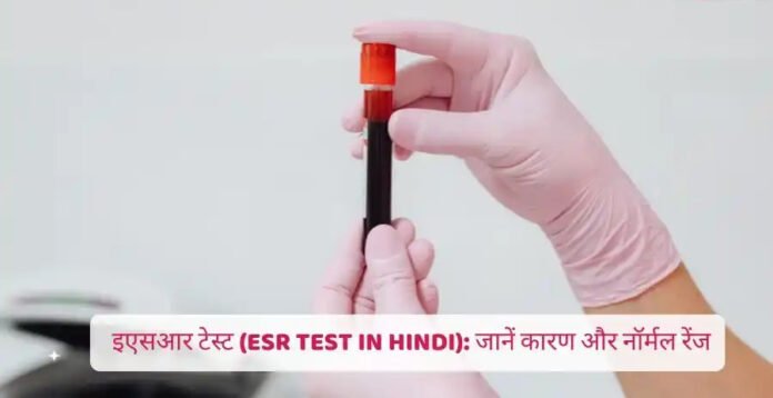 ESR टेस्ट क्यों जरूरी होता है? इंफेक्शन में बढ़ने-घटने के क्या संकेत देता है ये ब्लड टेस्ट