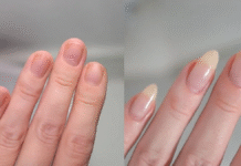 बार-बार टूट जाते हैं नाखून? रात को सोने से पहले अपनाएं ये आसान उपाय, तेजी से होगी ग्रोथ