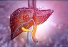 दुनियाभर में बढ़ रही लिवर की बीमारी, 2050 तक 2 अरब लोग हो सकते हैं प्रभावित: रिपोर्ट