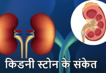 किडनी स्टोन में पेशाब से खून आना कितना खतरनाक? जानें वजह और कब लें डॉक्टर की सलाह
