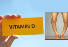 बच्चों में विटामिन D की कमी से बढ़ सकता है रिकेट्स और कमजोर हड्डियों का खतरा