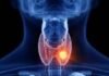 World Thyroid Day: थायराइड से जुड़े मिथकों पर न करें भरोसा, जानें सही तथ्य